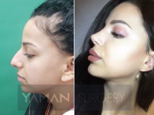 Yaman Plastic Surgery