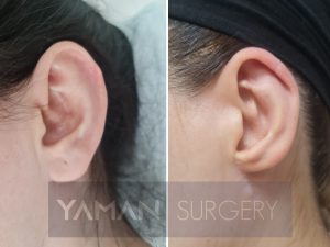 Yaman Plastic Surgery